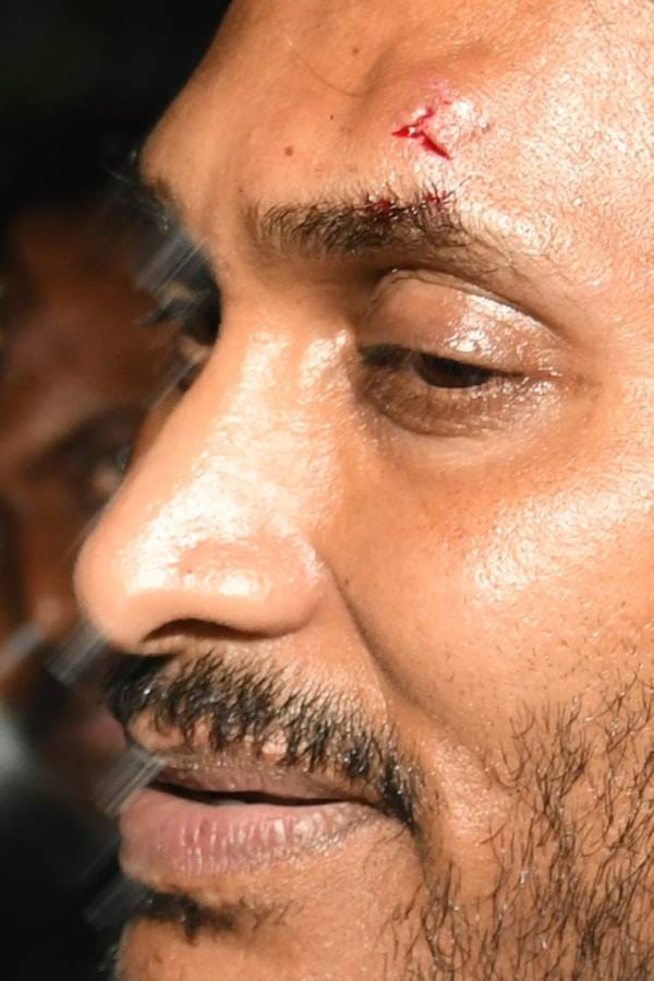 Stone Attack on AP CM Jagan -